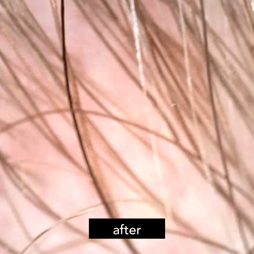 Chebula & Green Tea Scalp Revival Follicle Stimulating Scrub - Image 3