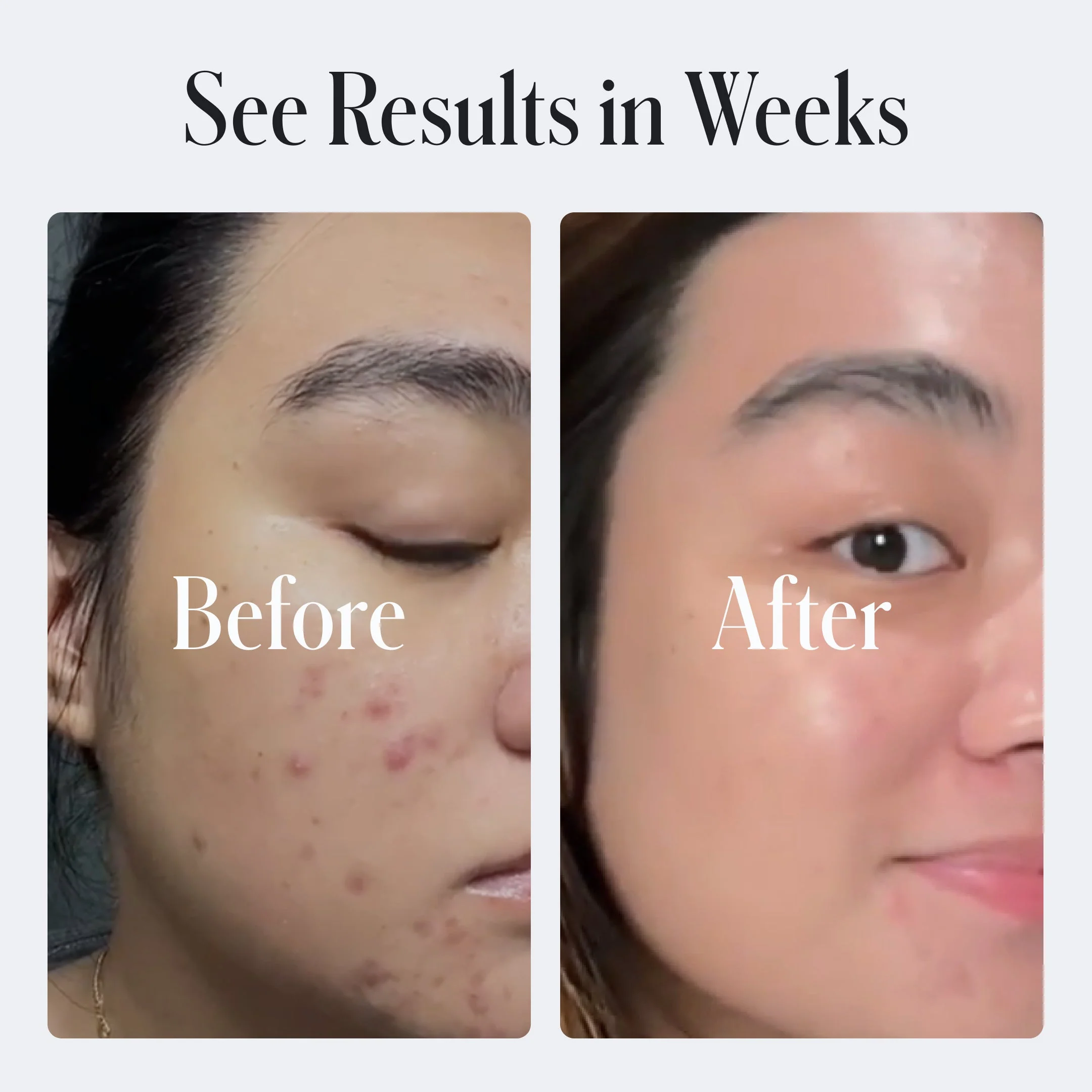 Clear Skin Face Cream - Image 11