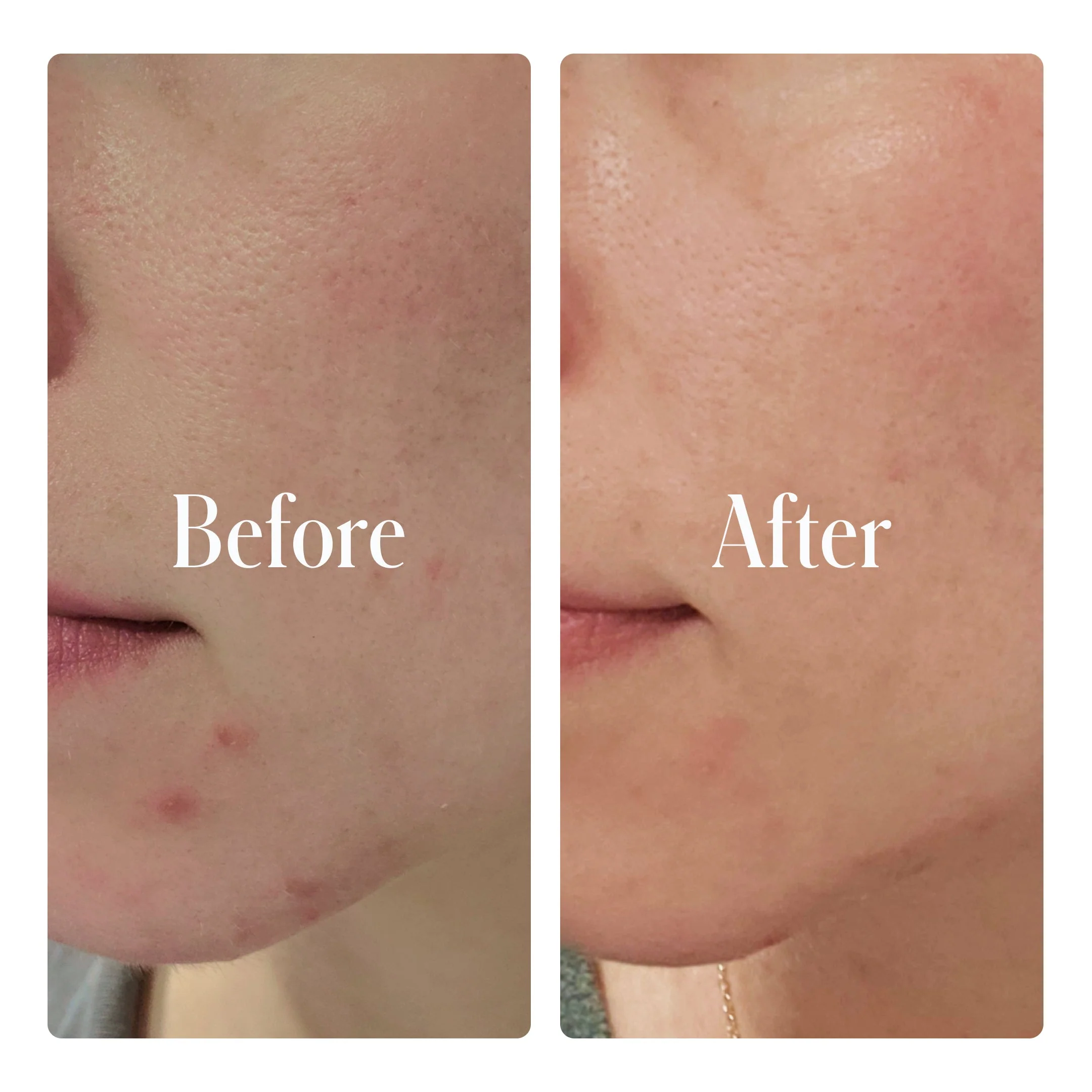Clear System Face Routine - Image 2