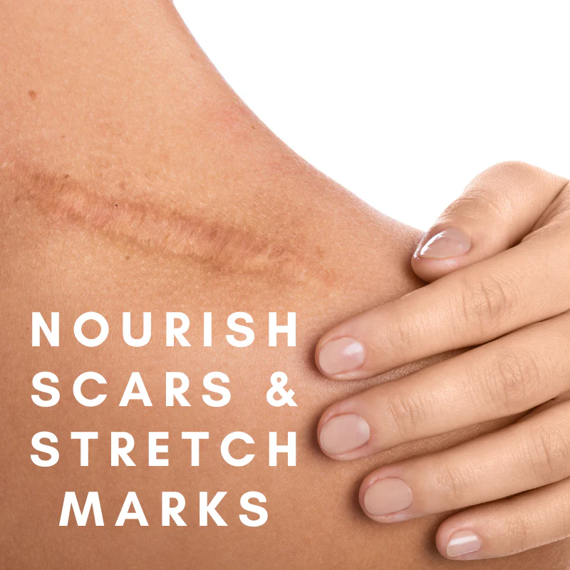 Shea & Moringa Balm - Image 7
