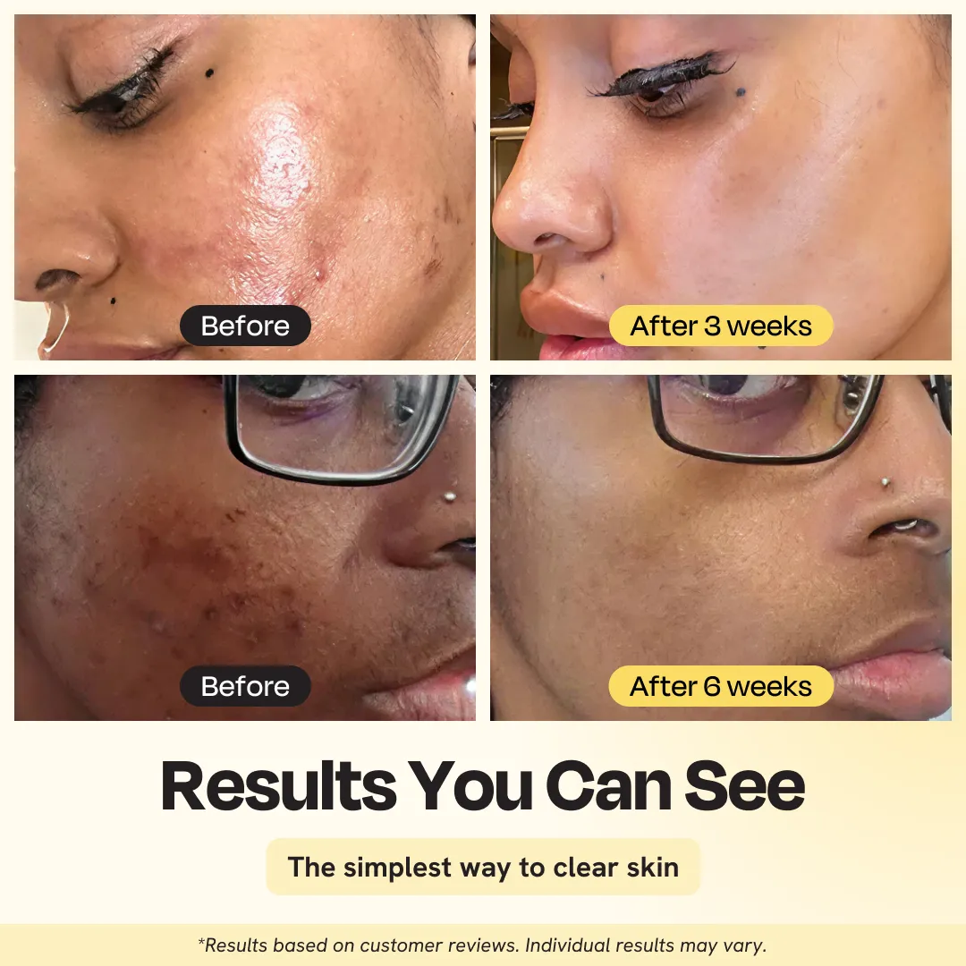Vitamin C Clay Mask - Image 3