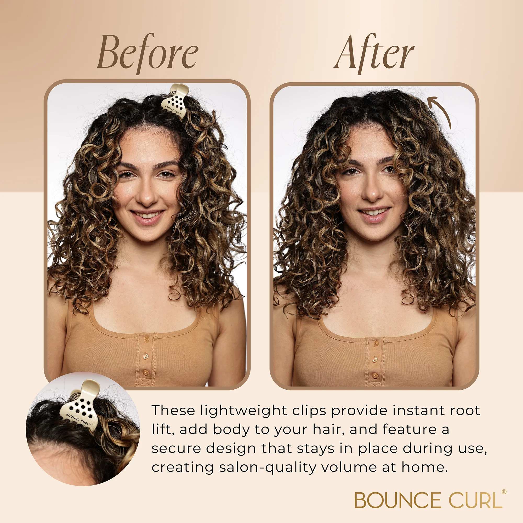 Volume Root Clips - Image 4