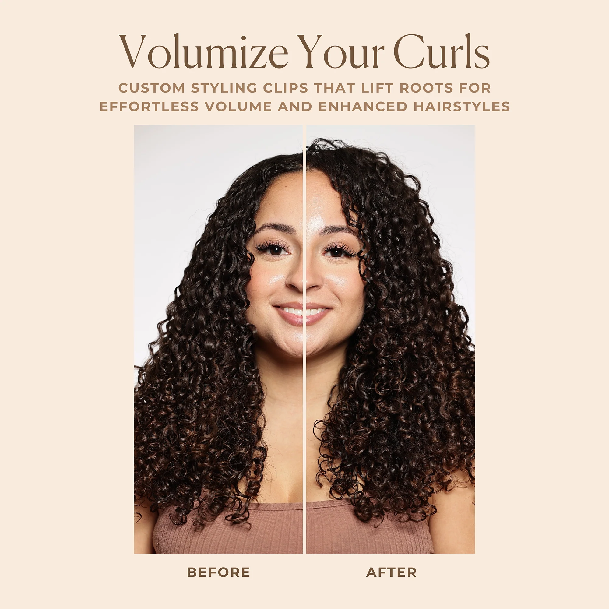 Volume Root Clips - Image 5